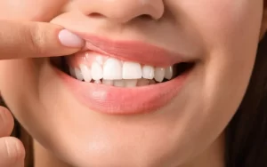 5 Signs Your Gums Need Help 1080x675 1 1024x640 1