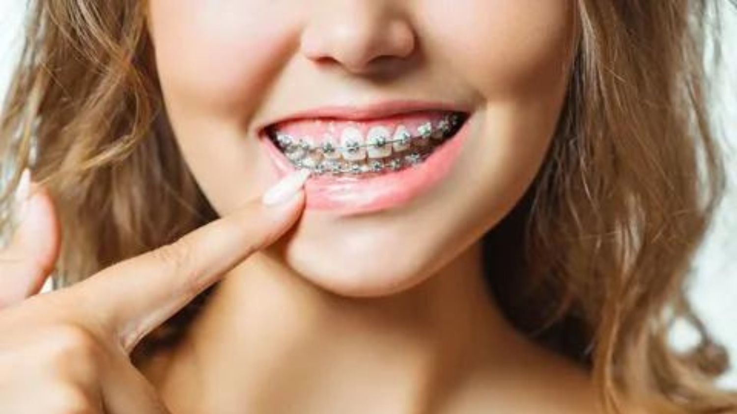 Dental clinic for braces in Faridabad
