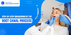 Step by Step Breakdown of the Root Canal Process