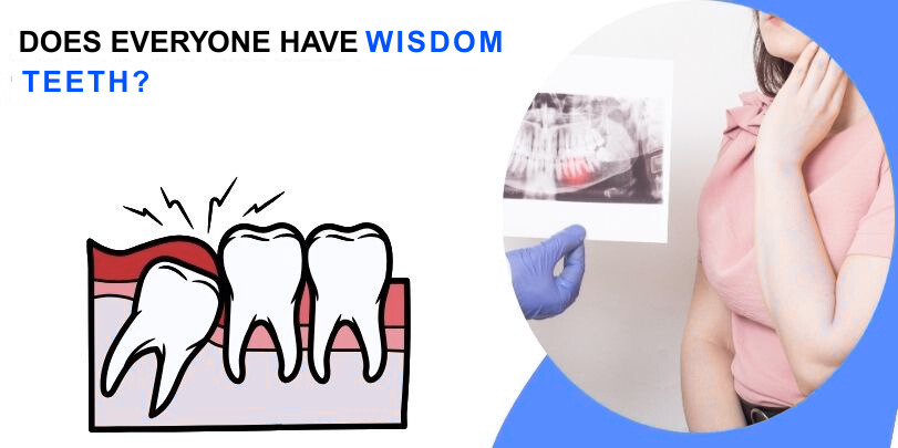 DOES EVERYONE HAVE WISDOM TEETH?