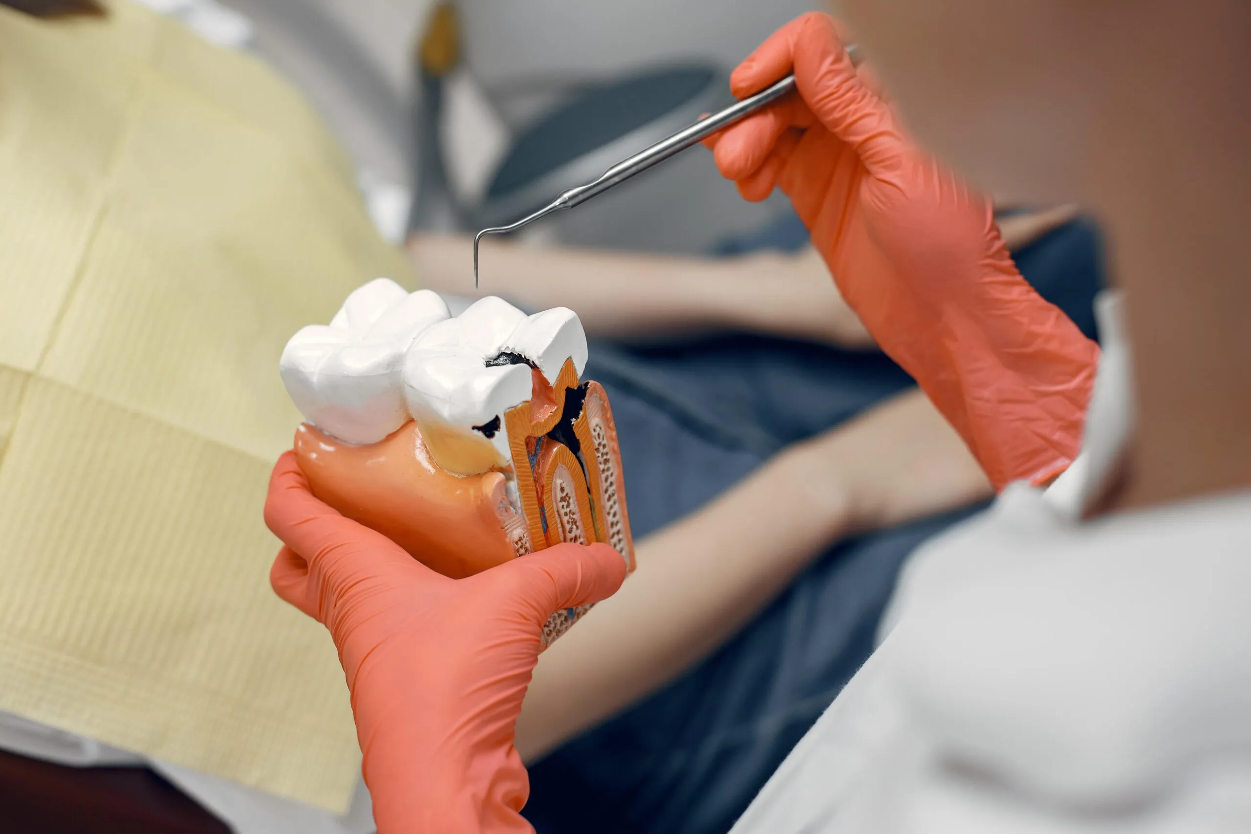 Painess Root Canal Treatment