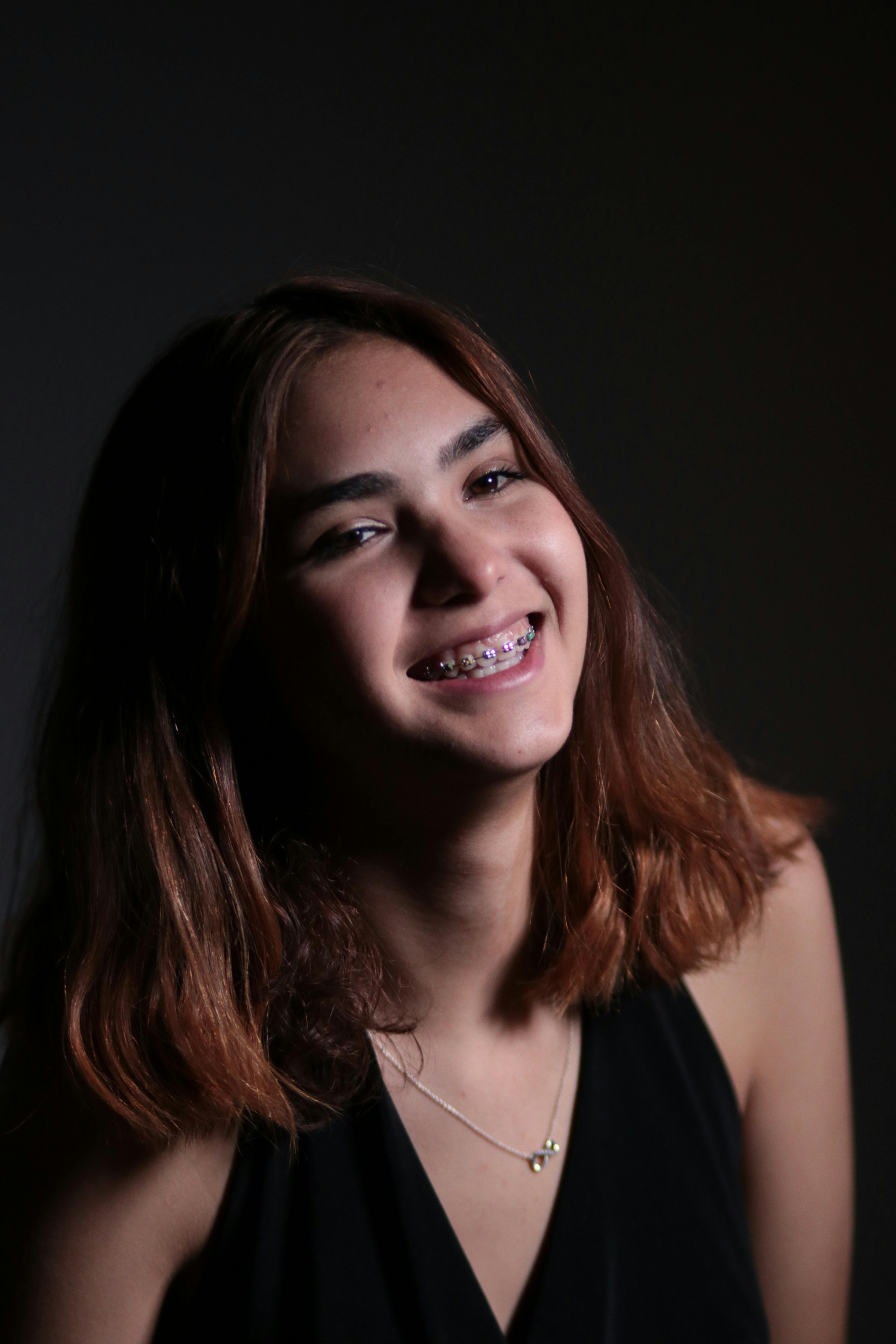 Orthodontic treatment results