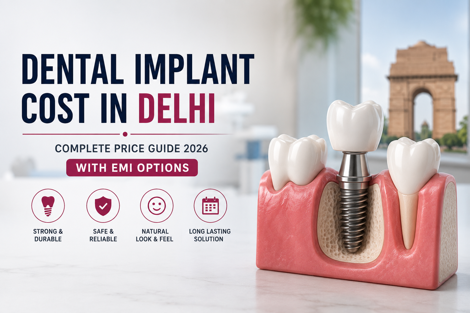 Dental Implant Cost in Delhi