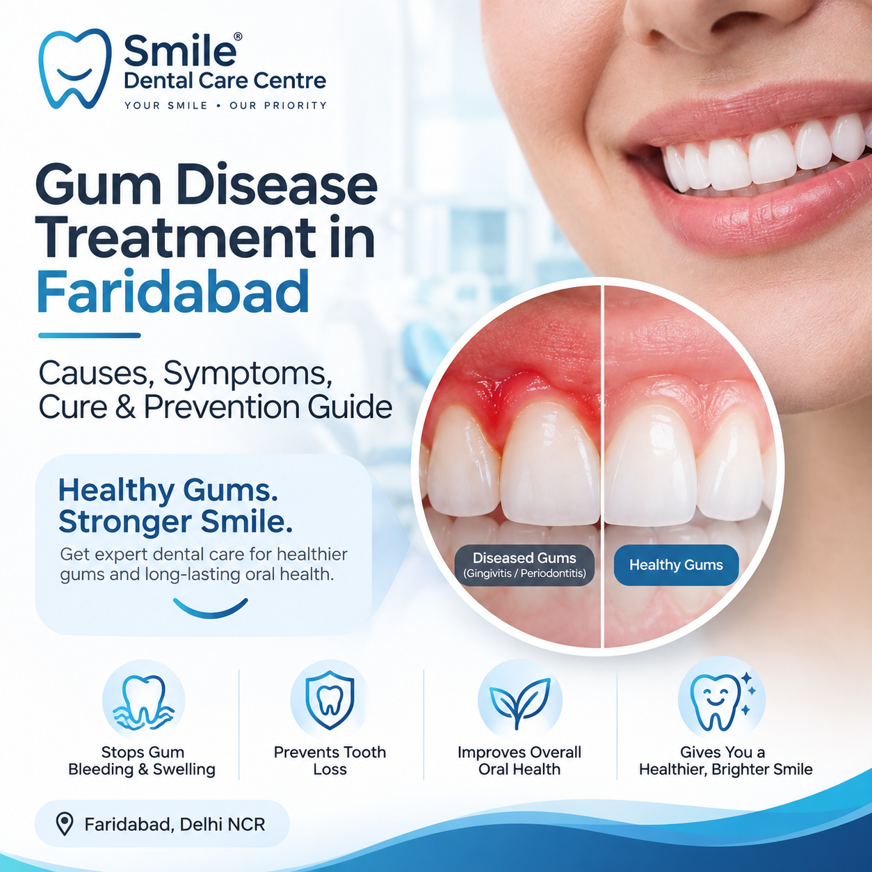Gum disease treatment in Faridabad at Smile Dental Care Centre