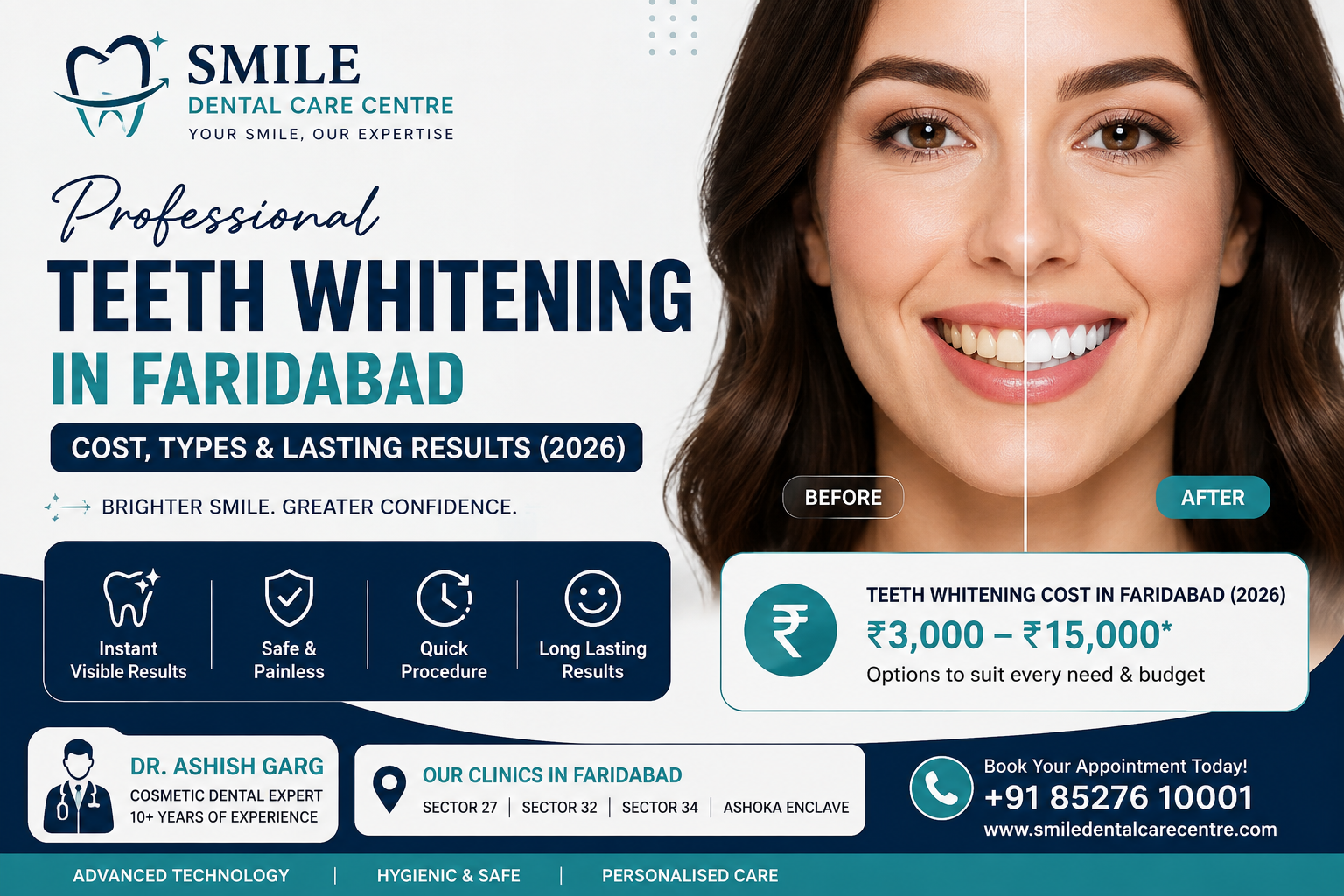 professional teeth whitening faridabad cost types results 2026